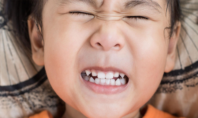 Скрежетание зубами во сне может вызвать неприятные осложнения… Как возникает бруксизм и как от него избавиться